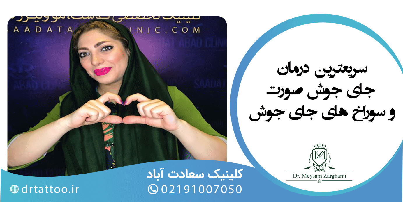 سریعترین درمان جای جوش صورت و سوراخ های جای جوش