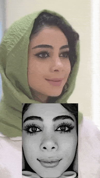 علت جوش صورت