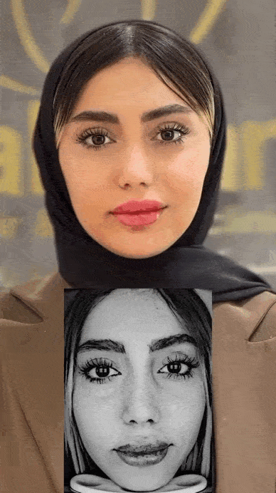 چگونه جای جوش را برطرف کنیم؟