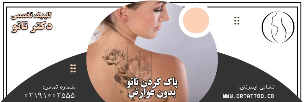 عوارض پاک کردن تاتو