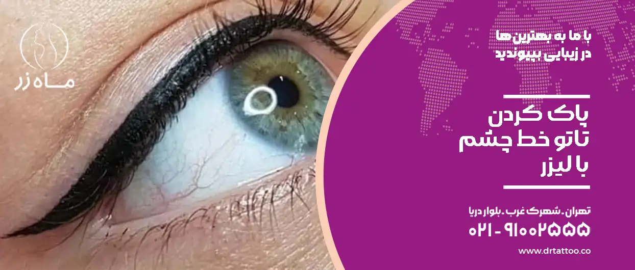پاک کردن تاتو خط چشم با لیزر