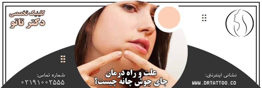 علت باقی ماندن جای جوش چانه چیست؟