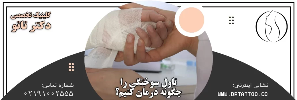 تاول سوختگی رو چیکار کنیم؟