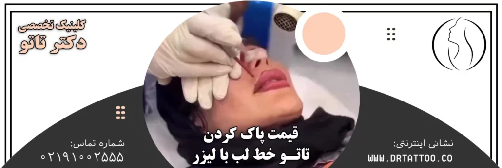 قیمت پاک کردن تاتو خط لب با لیزر