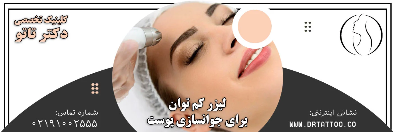 لیزر کم توان برای جوانسازی پوست