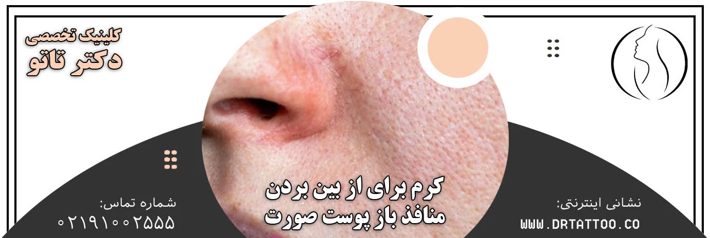 کرم برای از بین بردن منافذ باز پوست صورت