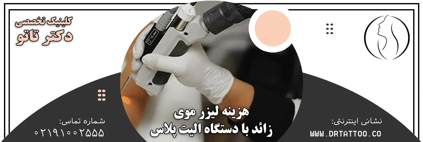 هزینه لیزر موی زائد با دستگاه الیت پلاس