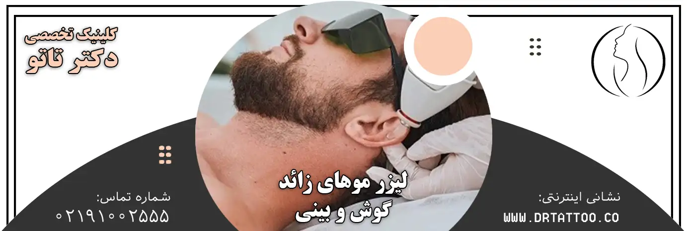لیزر موهای زائد گوش و بینی