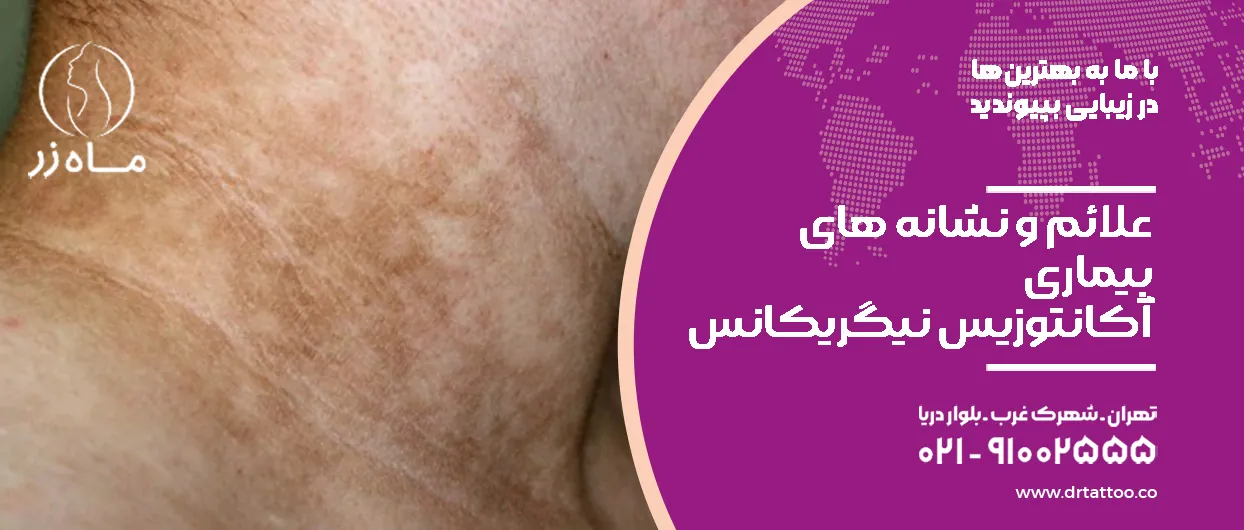 علائم و نشانه های بیماری آکانتوزیس نیگریکانس