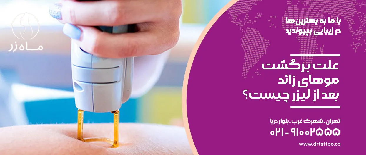 علت برگشت موهای زائد بعد از لیزر چیست؟