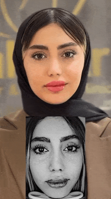 لیزر اربیوم کک و مک چند جلسه است؟