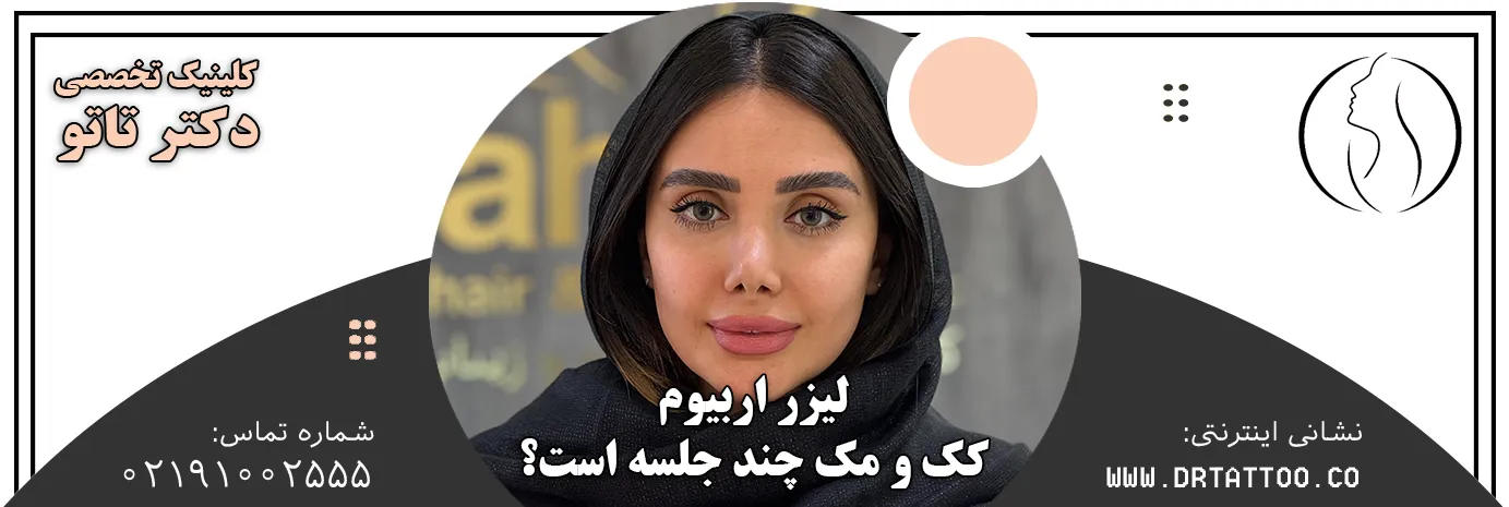 لیزر اربیوم کک و مک چند جلسه است؟