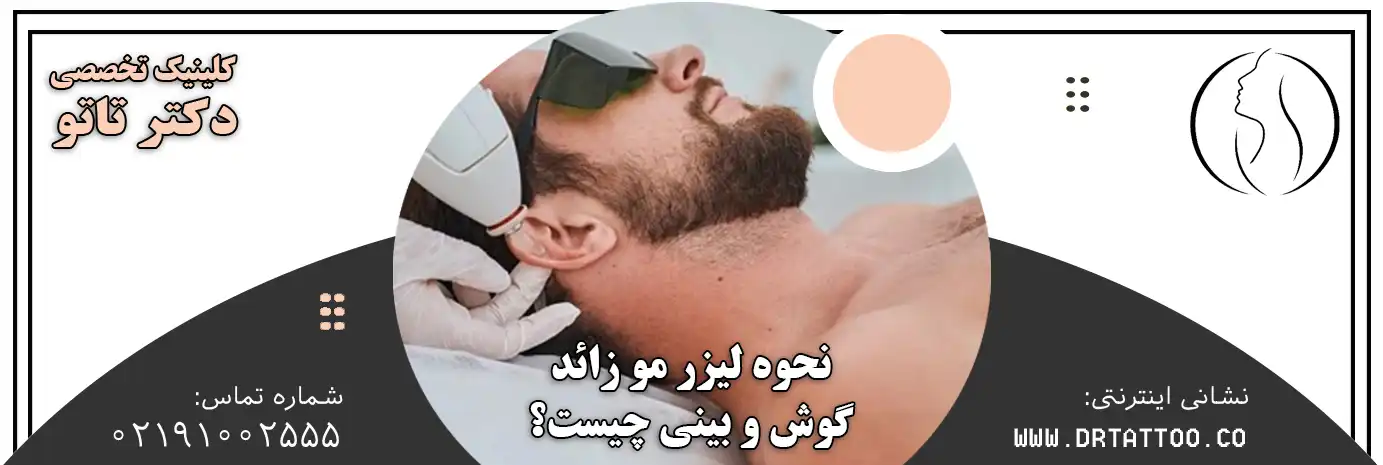 نحوه لیزر مو زائد گوش و بینی