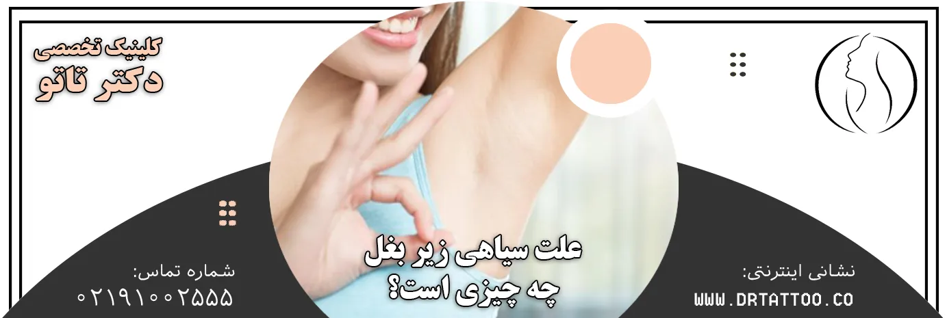 علت سیاهی زیر بغل
