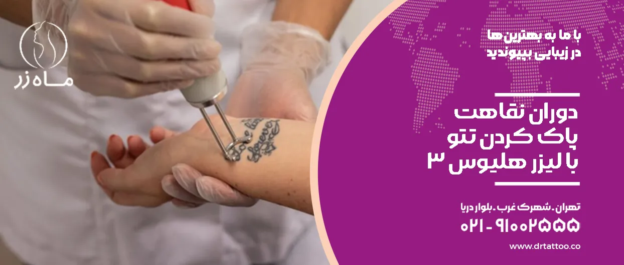 نقاهت پاک کردن تتو با لیزر هلیوس ۳