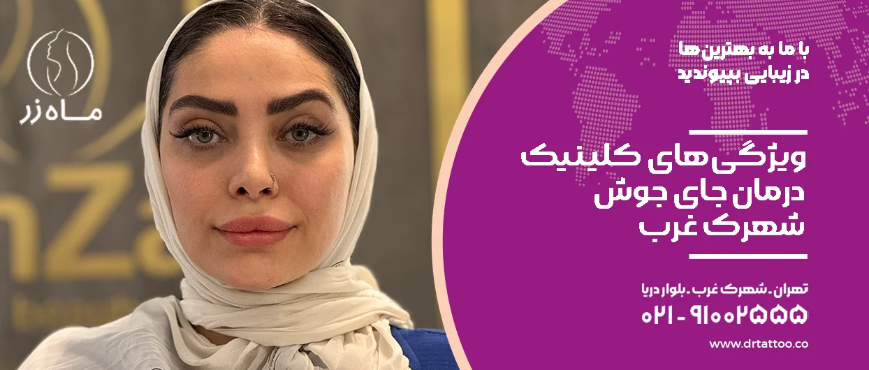 ویژگی‌های کلینیک درمان جای جوش شهرک غرب