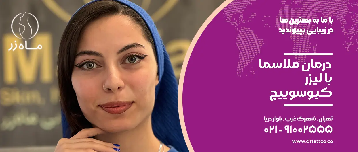 درمان ملاسما با لیزر کیوسوییچ Co2