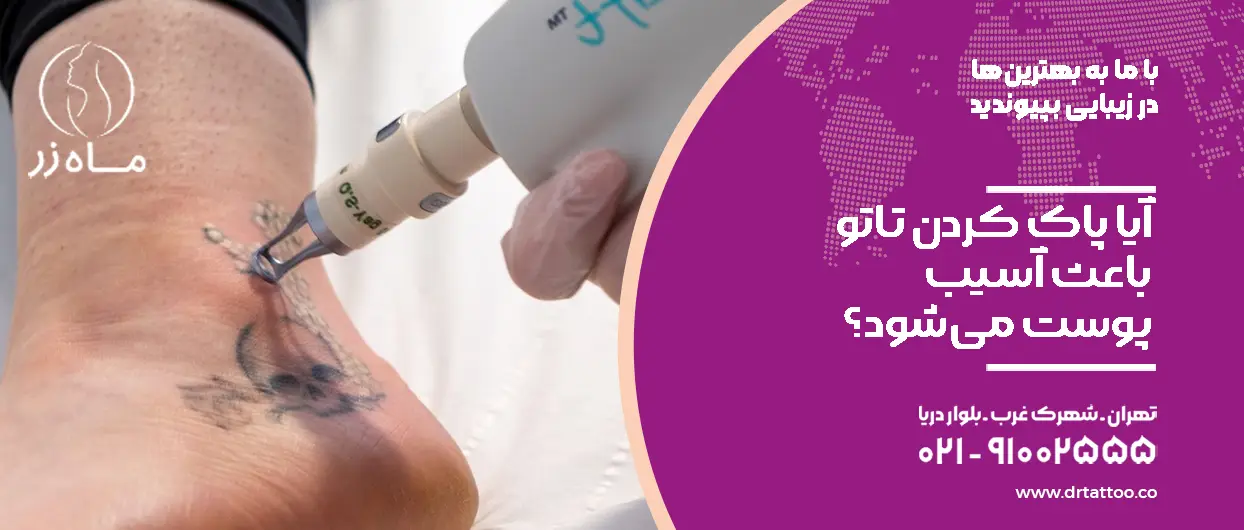 آیا پاک کردن تاتو باعث آسیب پوست می‌شود؟