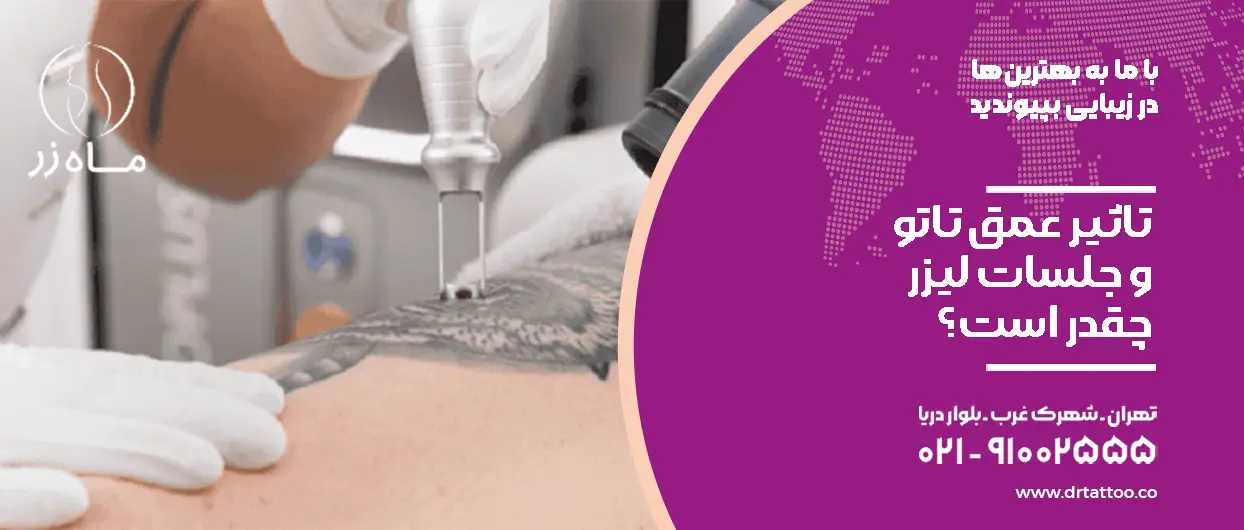 تاثیر عمق تاتو و جلسات لیزر
