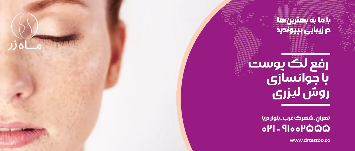 رفع لک با جوانسازی لیزری