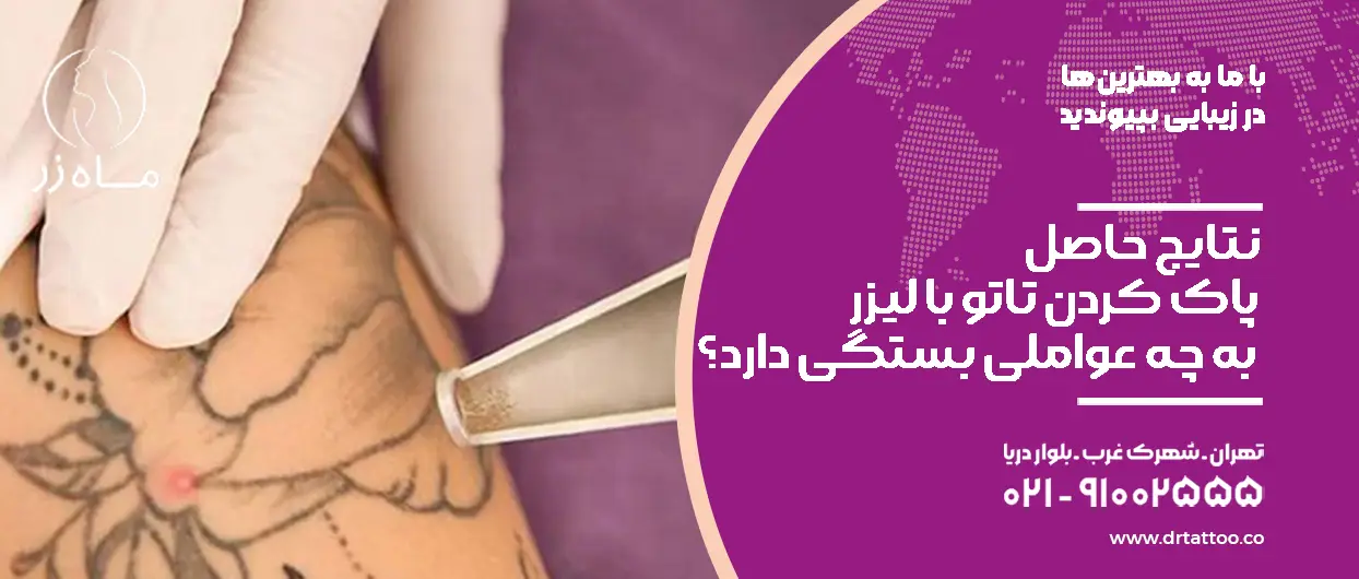 نتایج حاصل پاک کردن تاتو با لیزر به چه عواملی بستگی دارد؟